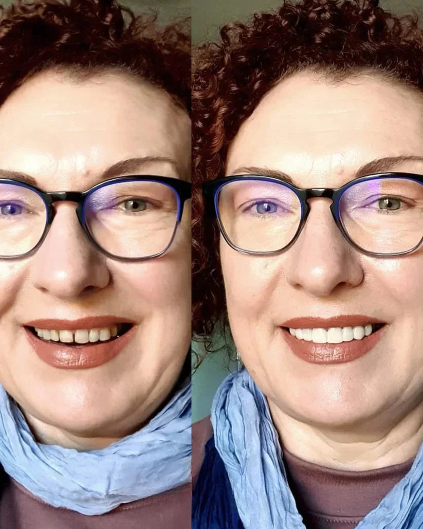 InstaSmile Pro
